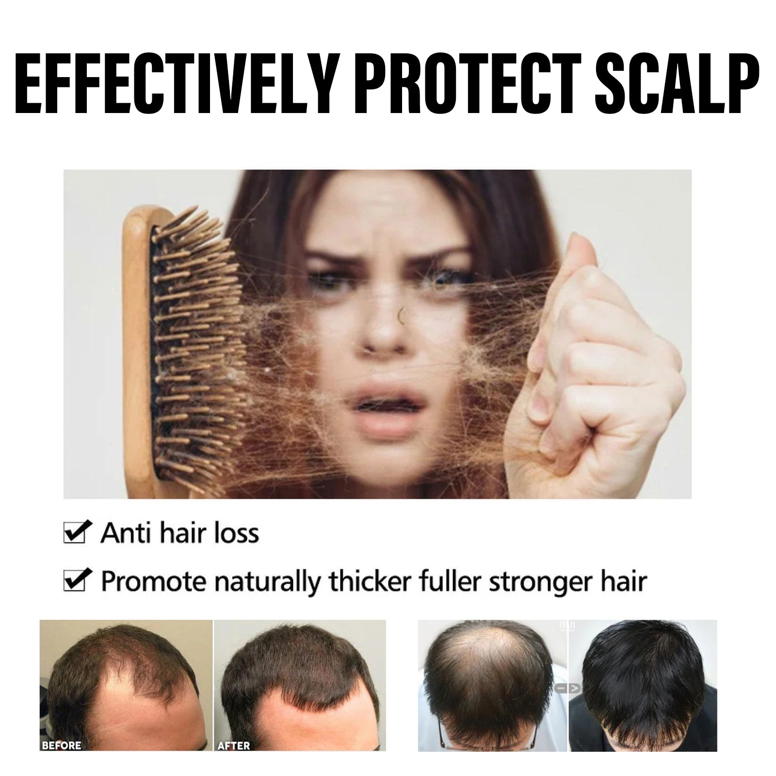 Hair Regrowth Capsules Thickens Accelerate Hair Growth in USA