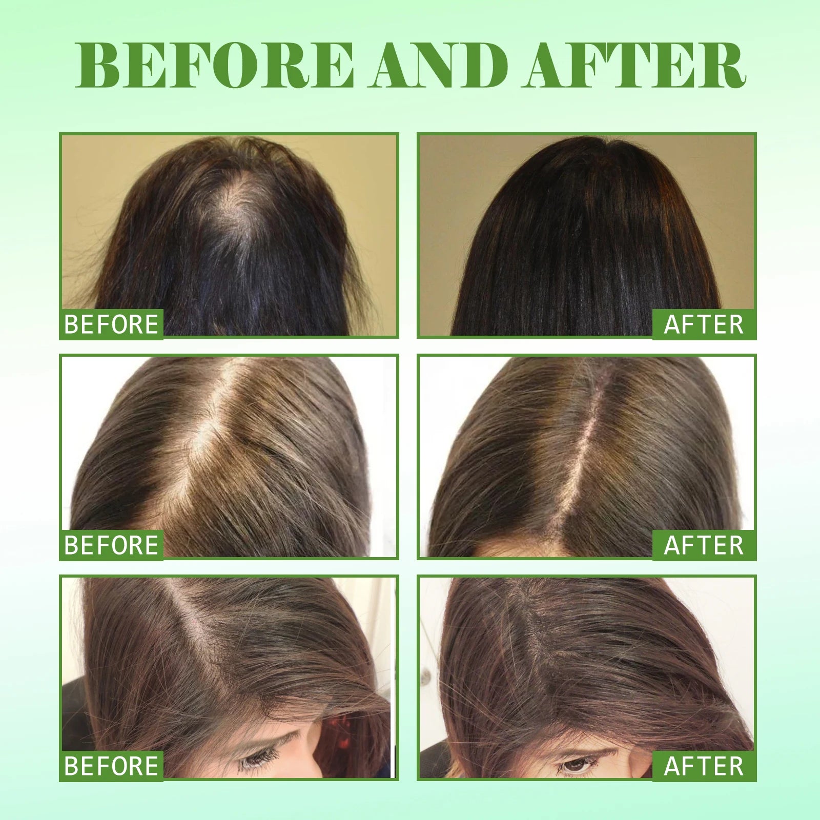 Rosemary Hair Care Products Promote Hair Growth in USA