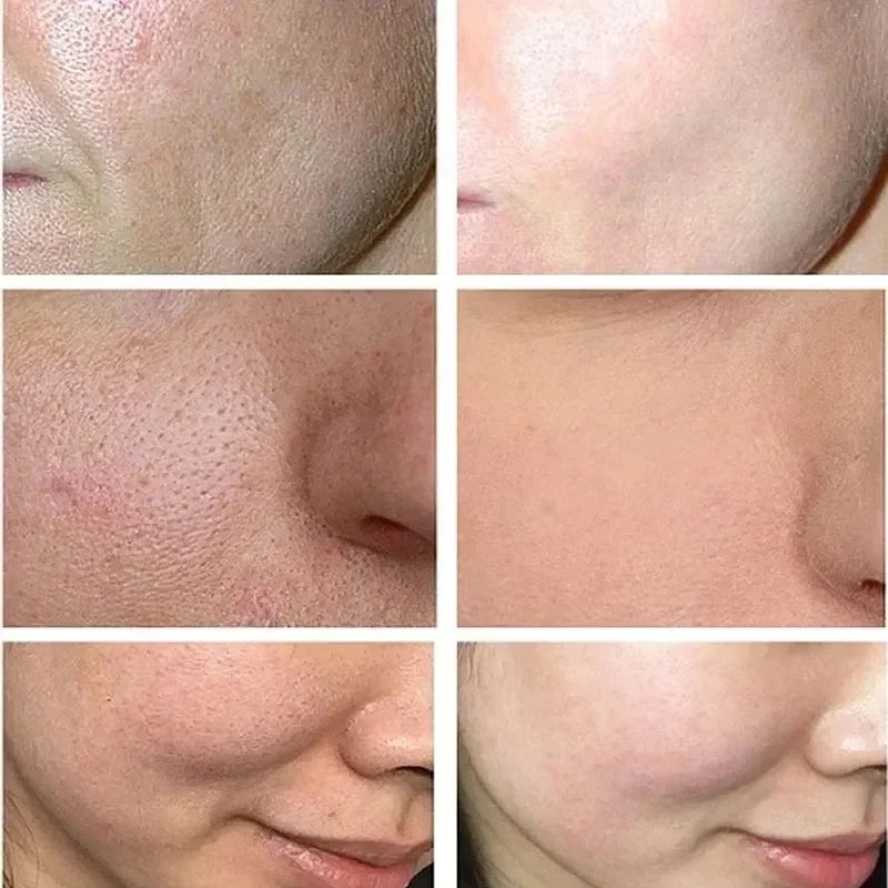 Enlarged Pores Repairing Facial Skin Moisturising Skin Care in USA