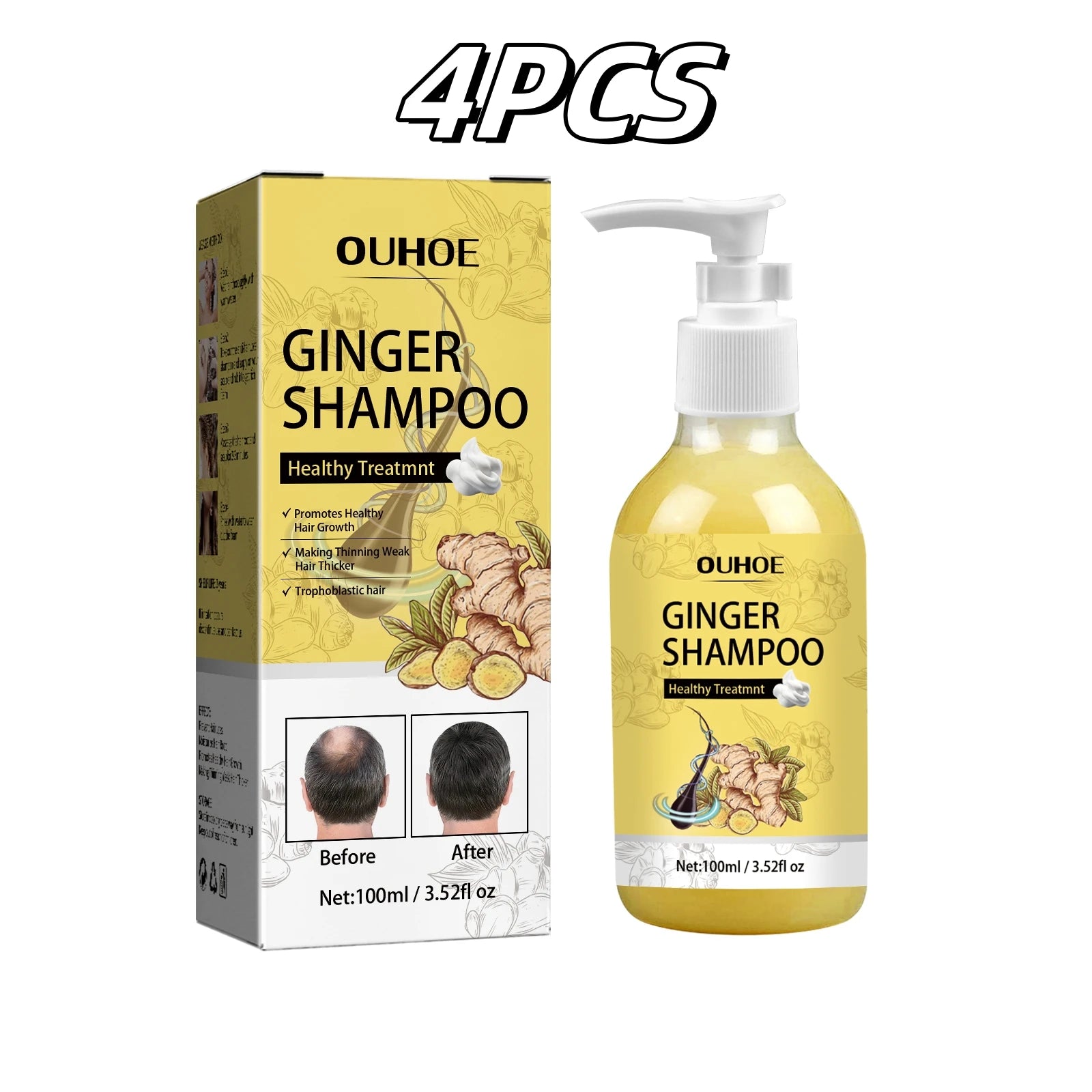 Ginger Shampoo Stable Promotes Healthy Hair Growth in USA