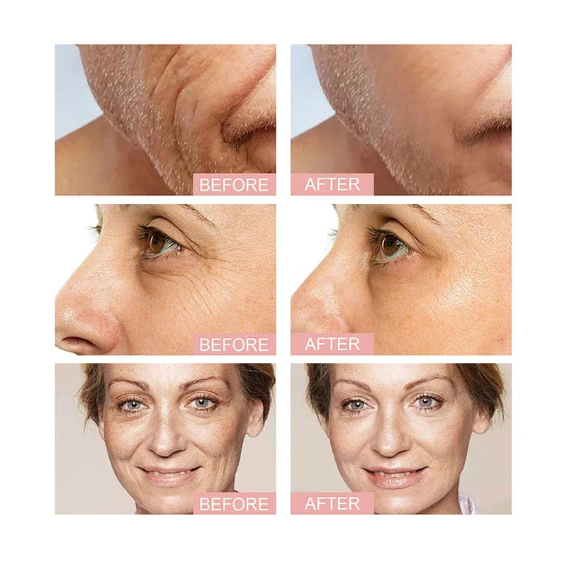 Anti Wrinkle Aging Eye Face Lift Tightening Moisturising in USA