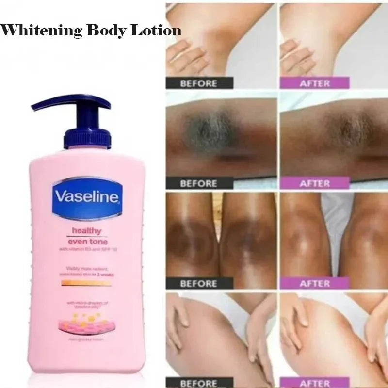 Vaseline Body Lotion Niacinamide Whitening Moisturizing in USA