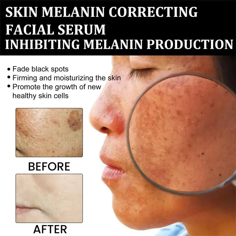 Melanin Facial Essence Whitening Vitamin C Extract Moisturise in USA