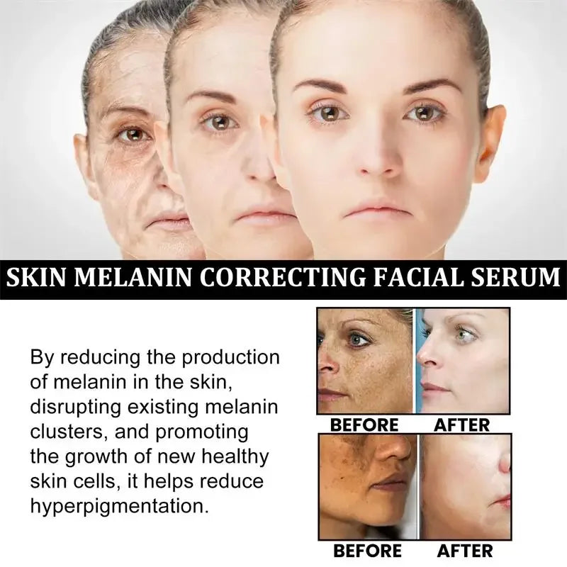 Melanin Facial Essence Whitening Vitamin C Extract Moisturise in USA