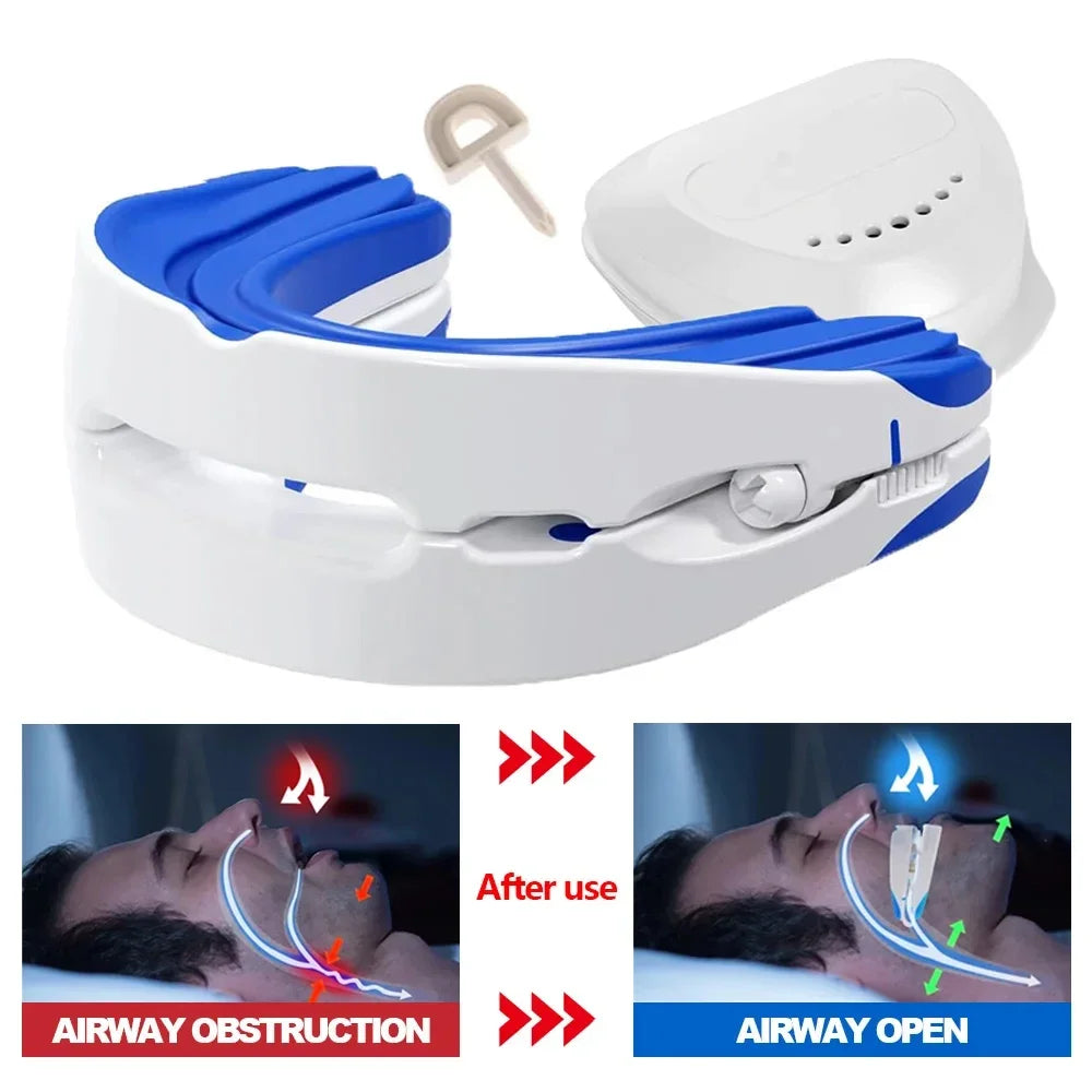 Device Teeth Bruxism Snoring Stopper Improve Sleep in USA