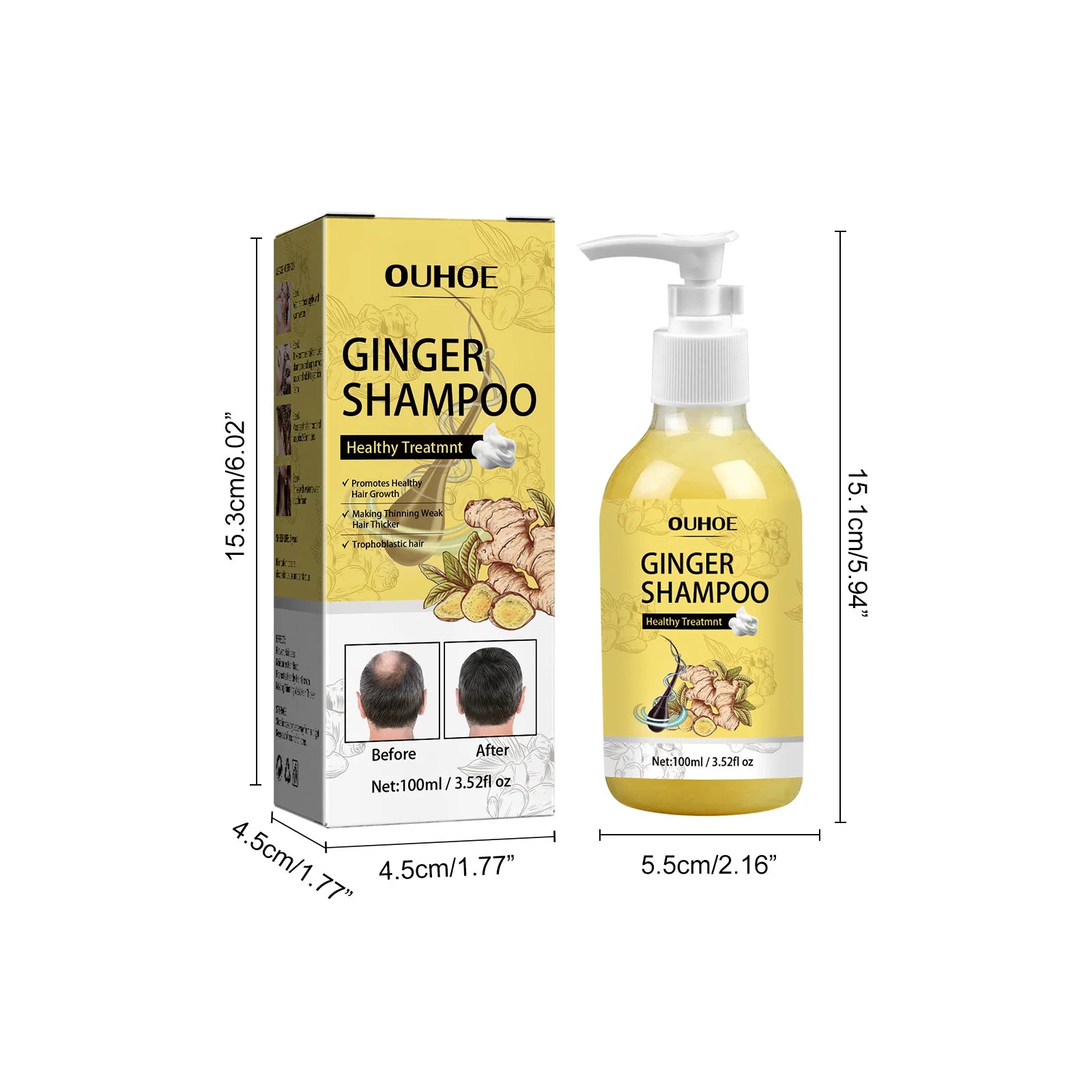 Ginger Shampoo Stable Promotes Healthy Hair Growth in USA