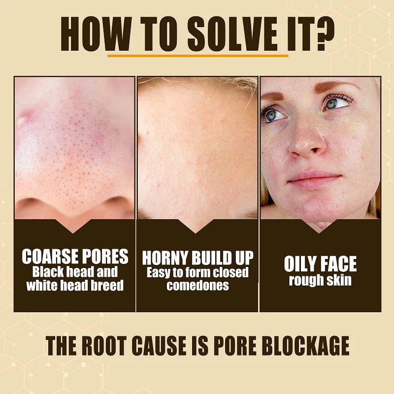 Enlarged Pores Repairing Facial Skin Moisturising Skin Care in USA