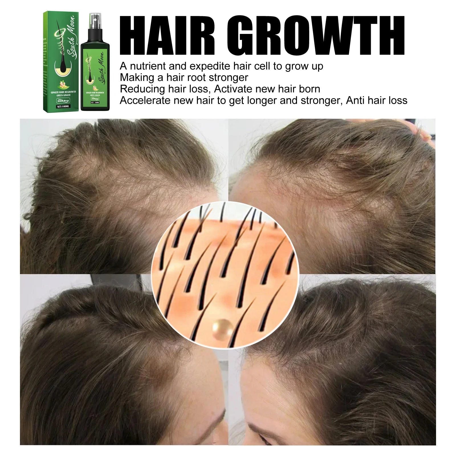 South Moon Green Ginger Hair Regrowth Spray in USA