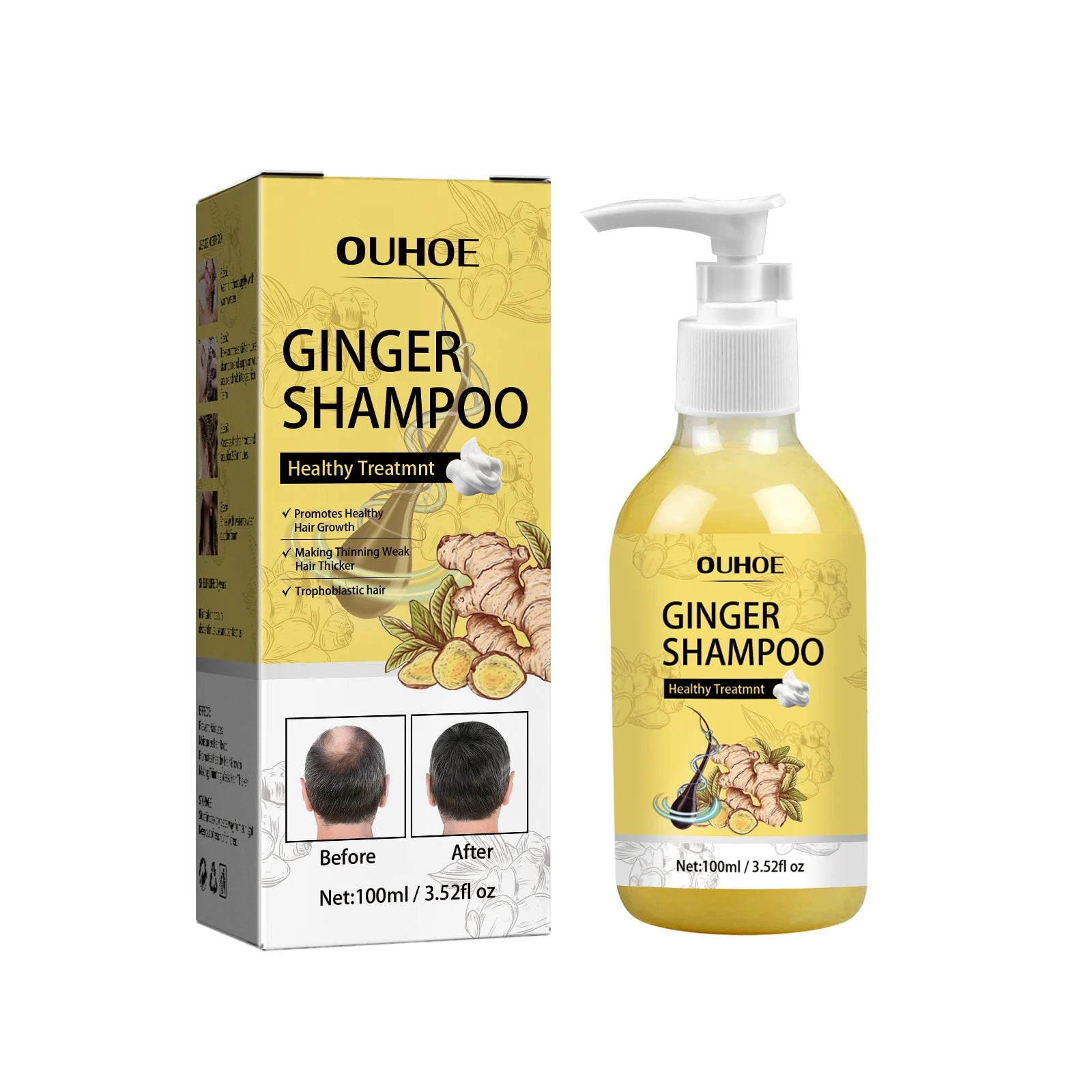 Ginger Shampoo Stable Promotes Healthy Hair Growth in USA