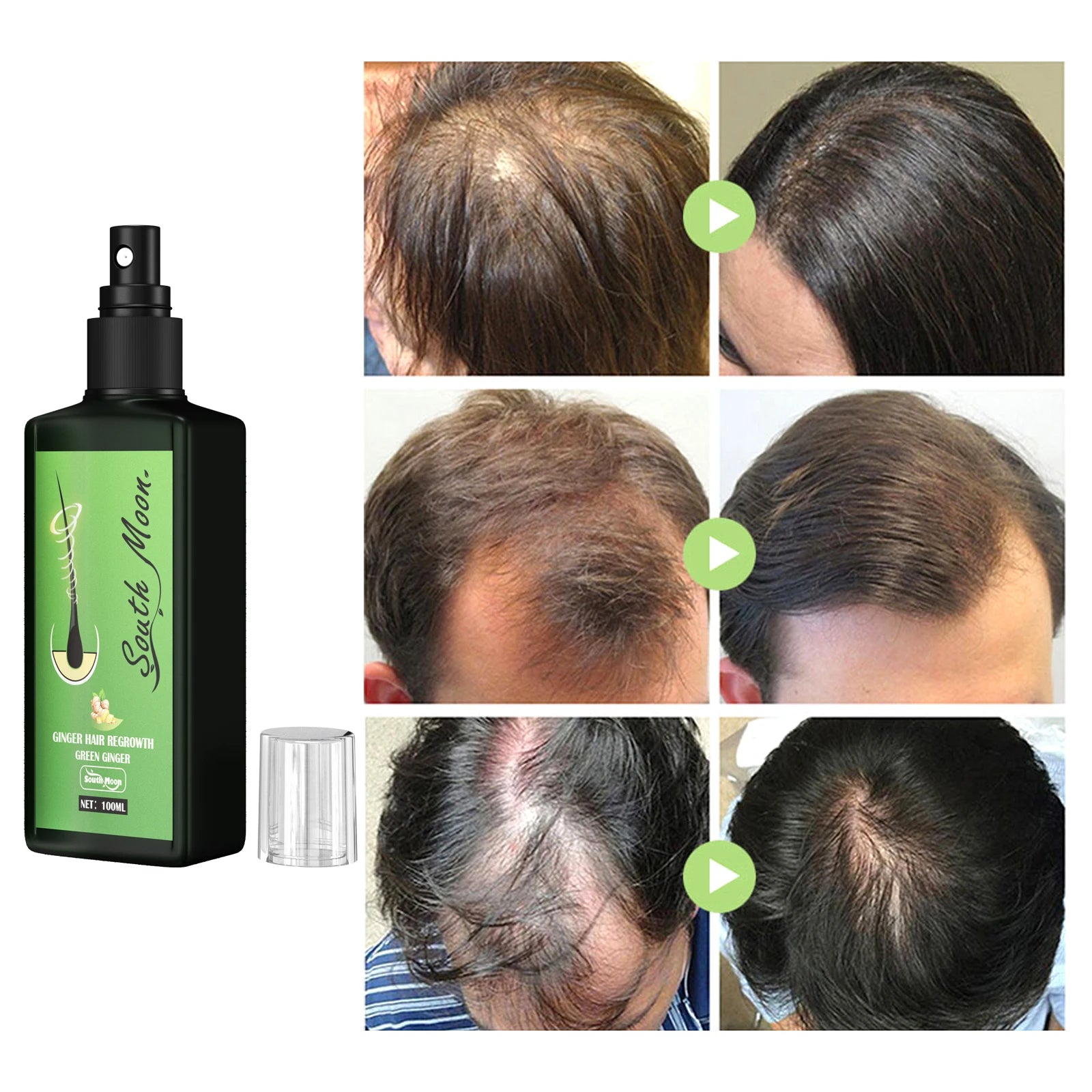 South Moon Green Ginger Hair Regrowth Spray in USA