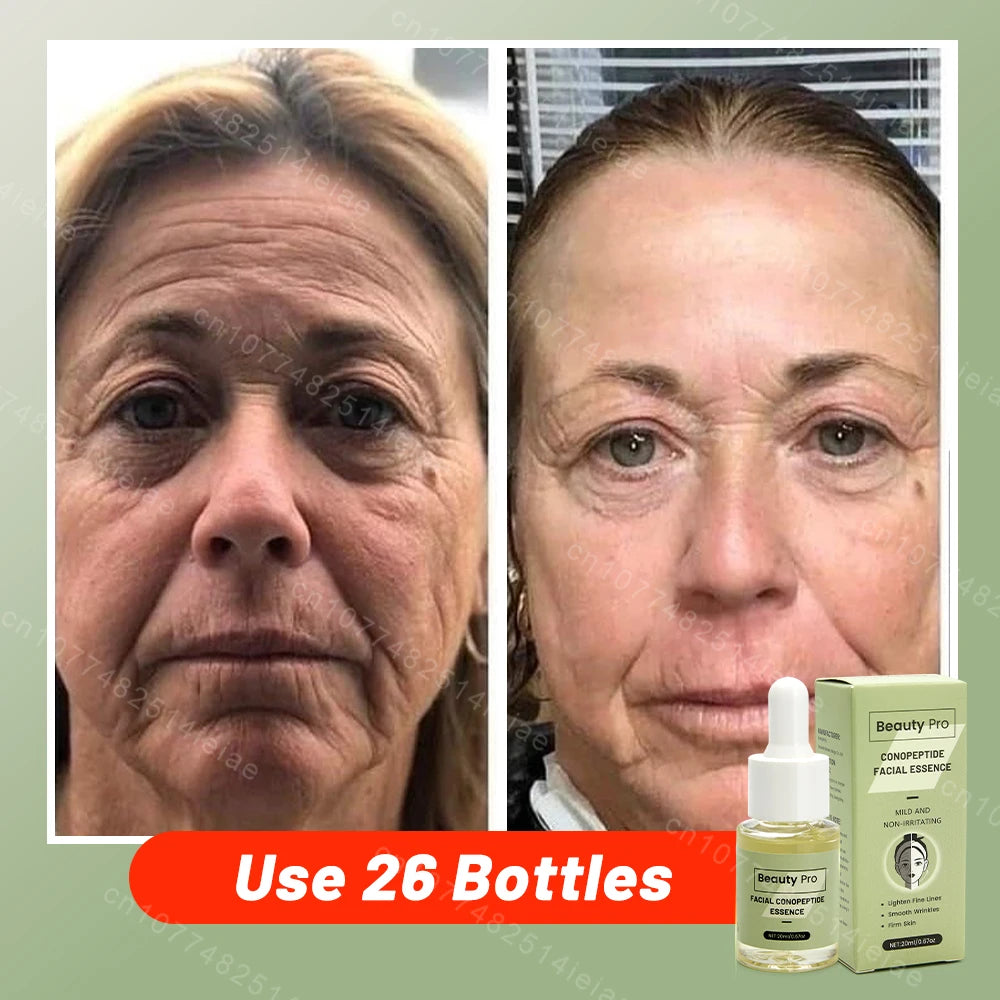 skin care Lift tighten reduce fine lines moisturize in USA