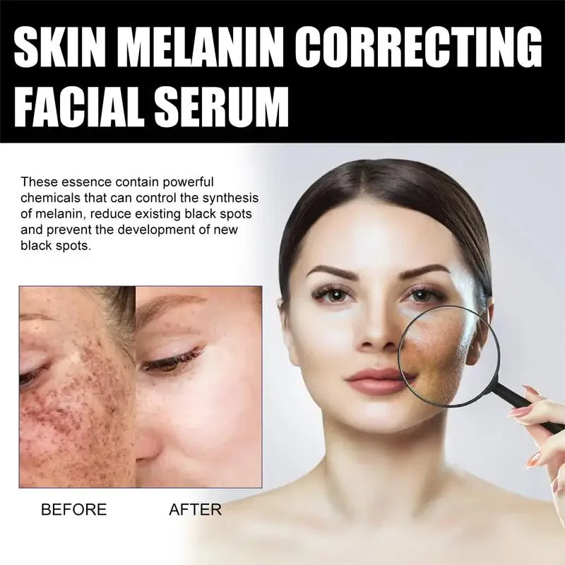 Melanin Facial Essence Whitening Vitamin C Extract Moisturise in USA