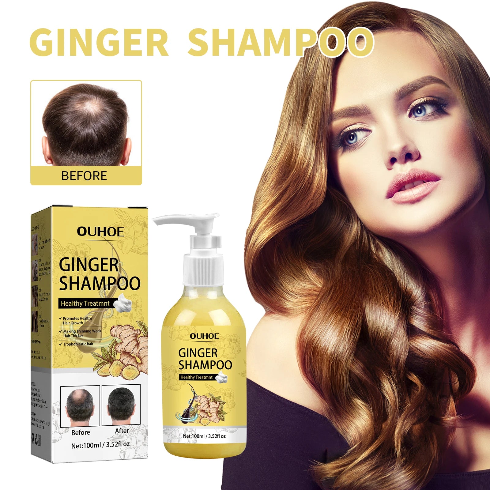 Ginger Shampoo Stable Promotes Healthy Hair Growth in USA