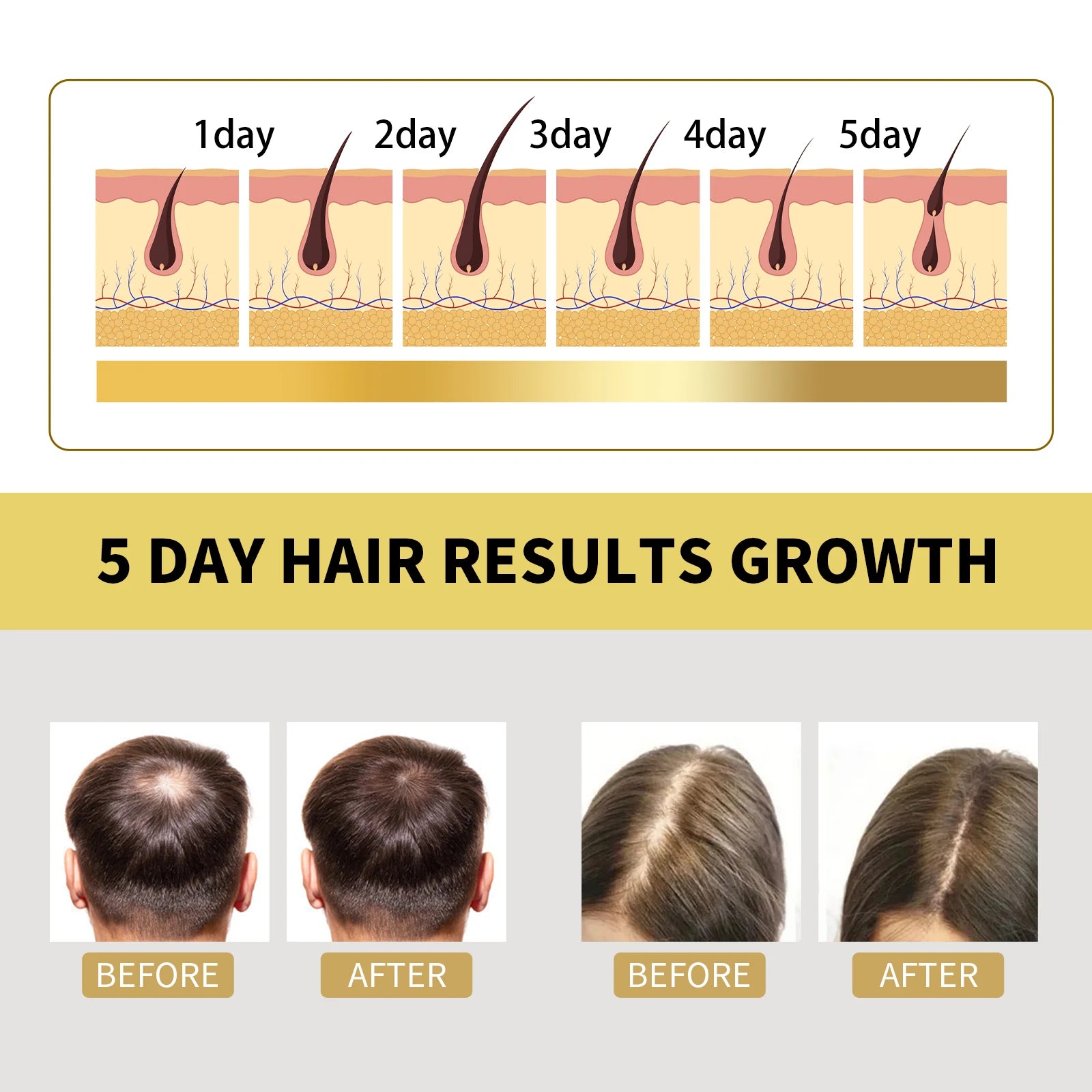 Ginger Shampoo Stable Promotes Healthy Hair Growth in USA