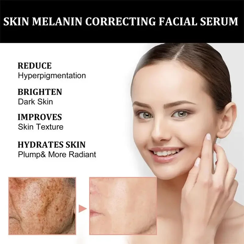 Melanin Facial Essence Whitening Vitamin C Extract Moisturise in USA